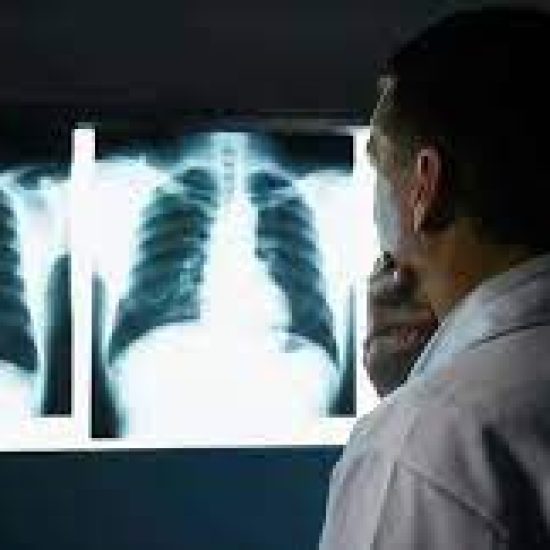 raio-x